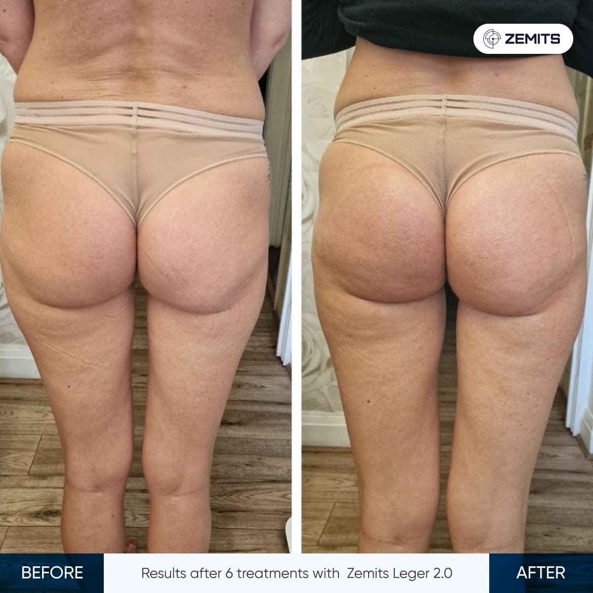 Zemits Leger 2.0 Results