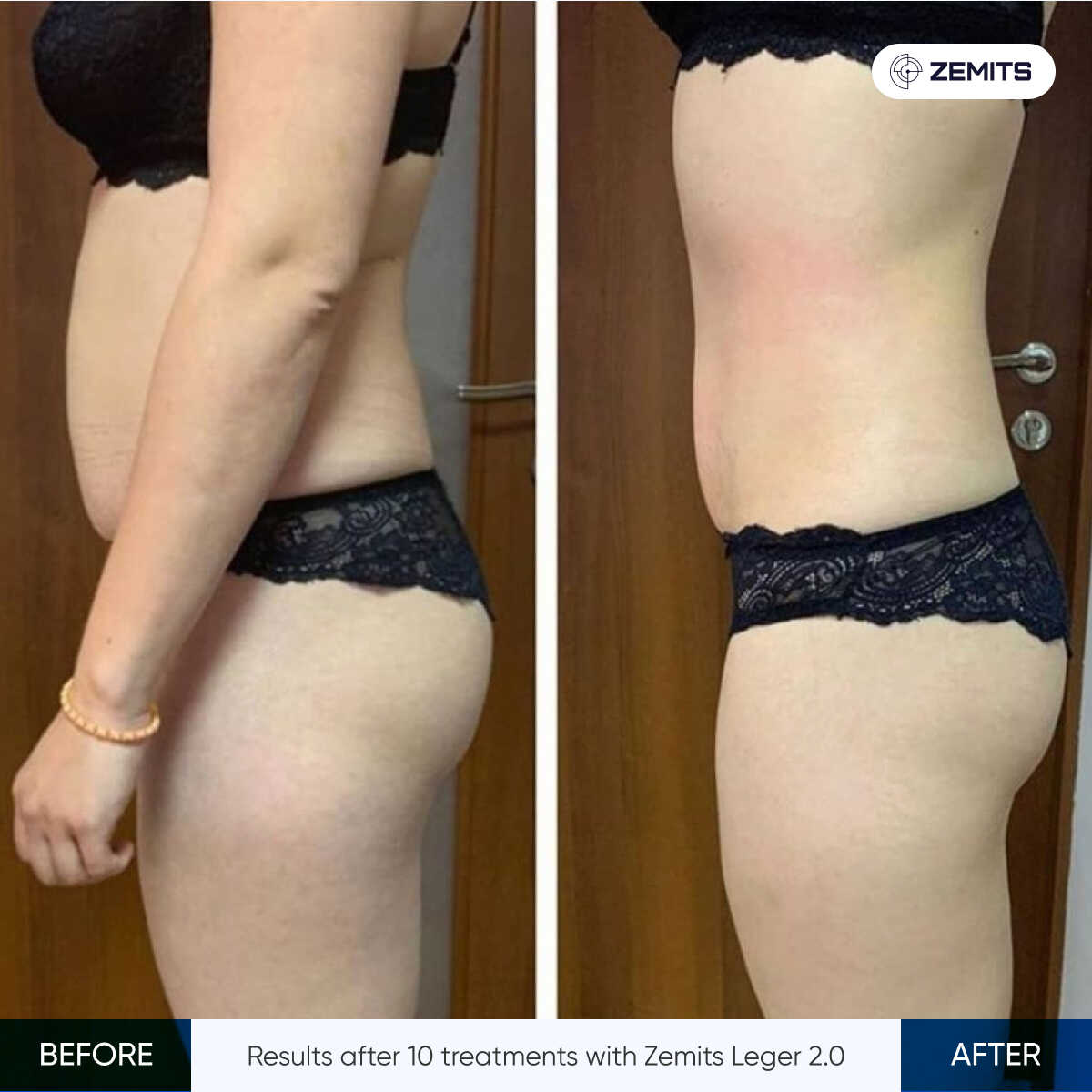 Zemits Leger 2.0 Toning