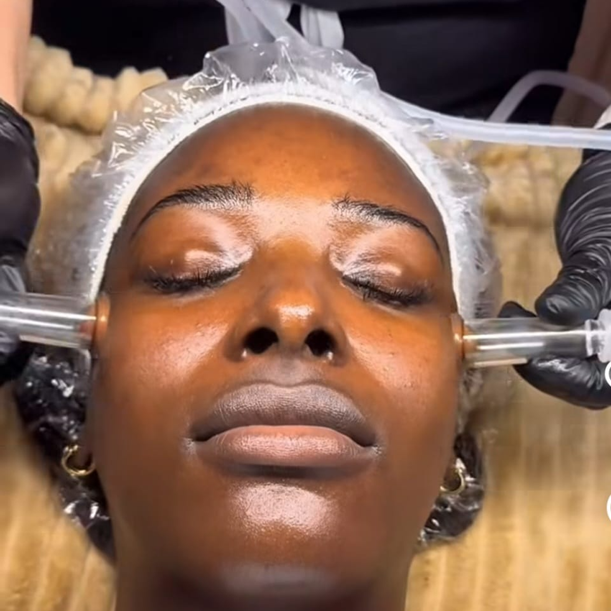 Glass Cupping - For Face