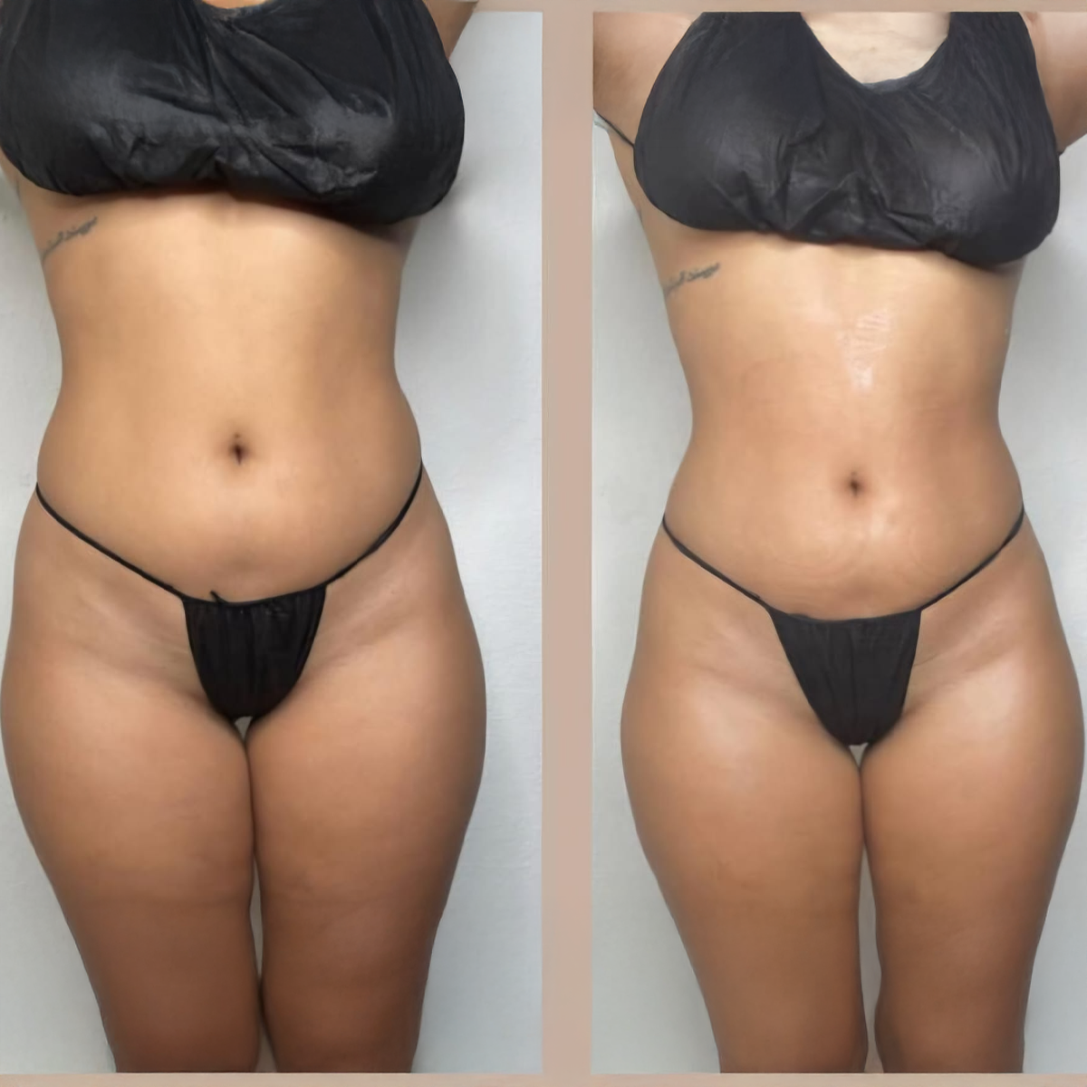 Zemits Leger Body Sculpting